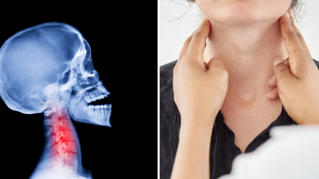 Doctors issue warning against oral sex over serious health implications