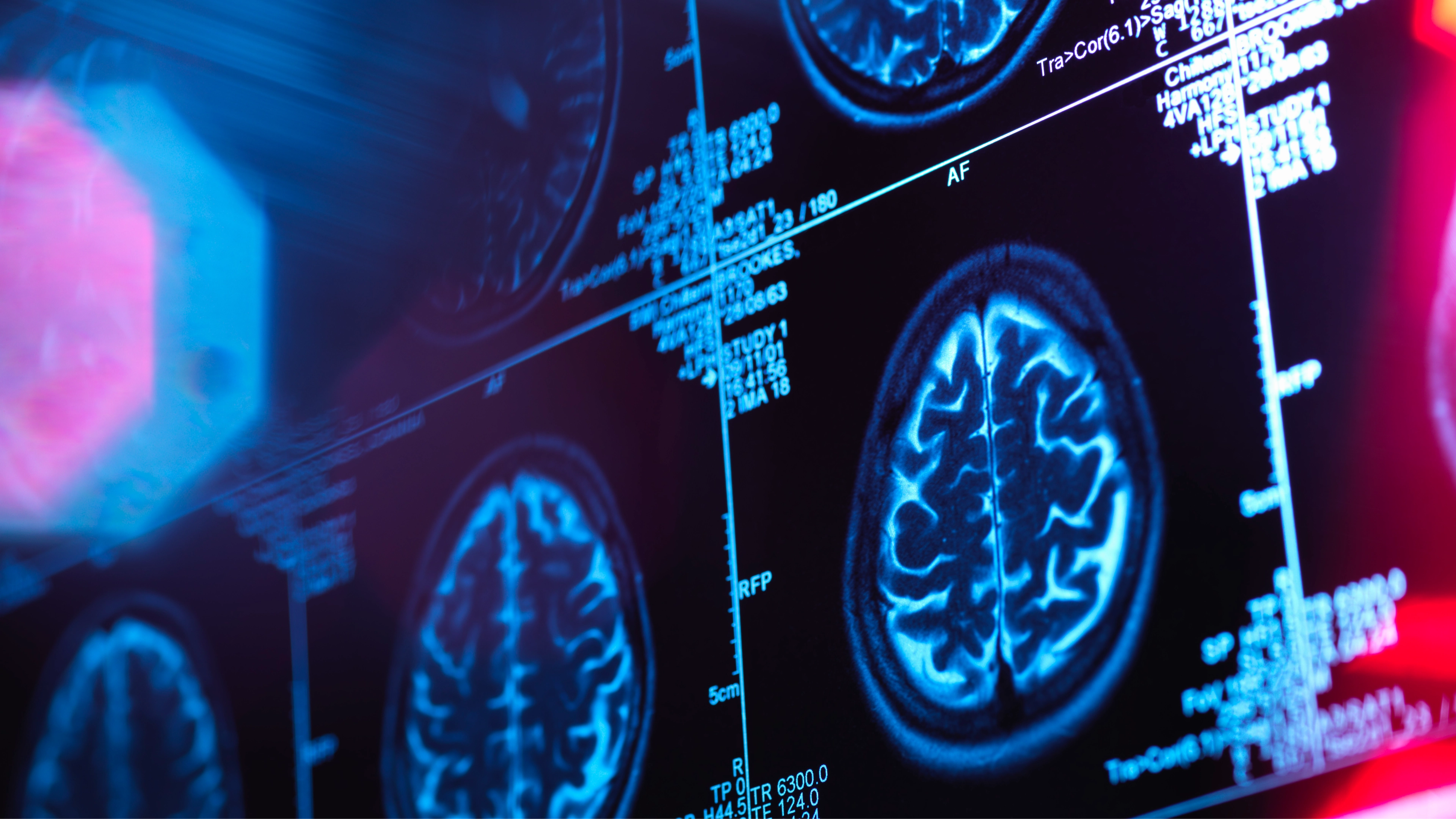 Neurologist reveals two early signs of dementia that aren’t to do with memory