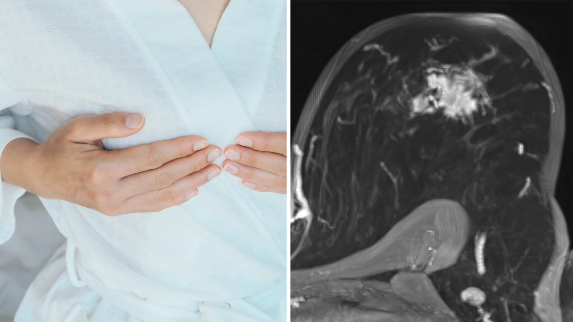 Seven 'silent killer' warning signs women need to look out for that could be signs of breast cancer