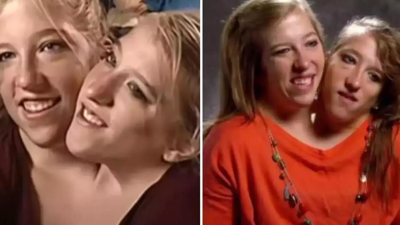 Conjoined twins Abby and Brittany Hensel have given answers after being asked questions everyone wants to know