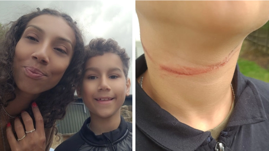 Mum says son was almost 'strangled to death' when fly curtain became tangled around his neck