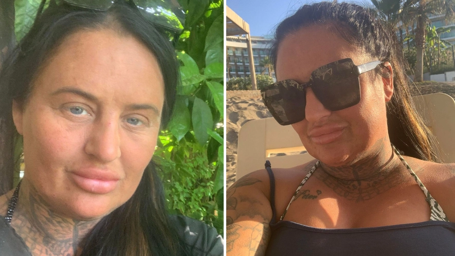 Mum thought she was ‘going to die’ after buying £75 'skinny jab' for her holiday