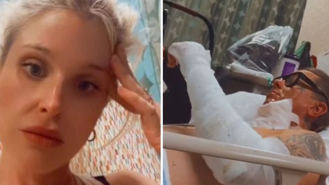 Kelly Osbourne issues warning after boyfriend is hospitalised with horrific burn injuries