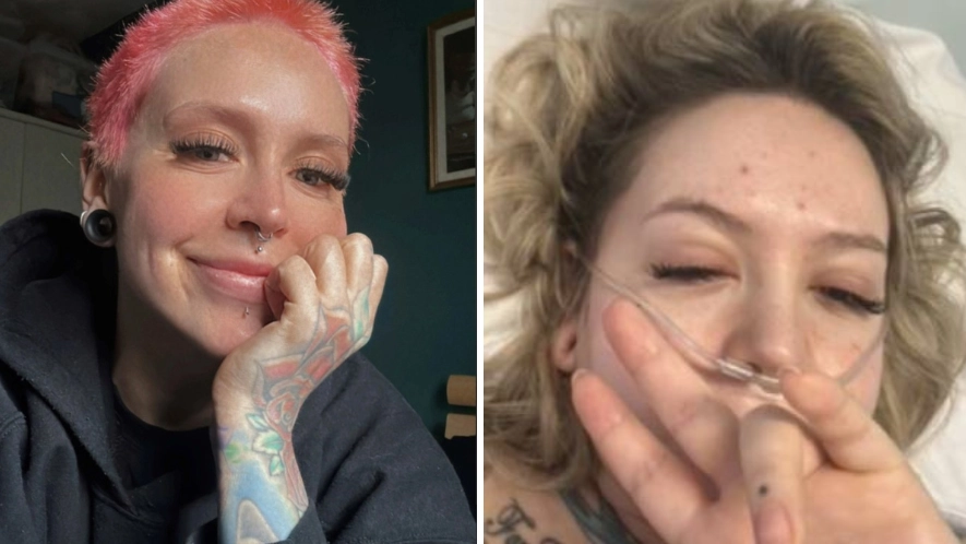 Woman who could see own tumour issues warning after being misdiagnosed by GP three times 