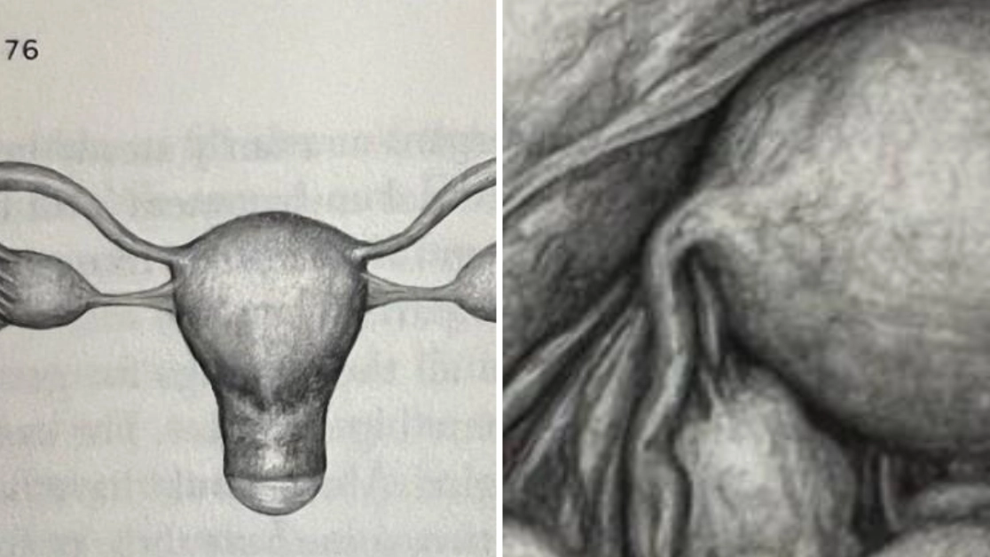 People only just realising what female pelvic anatomy actually looks like and they’re not impressed