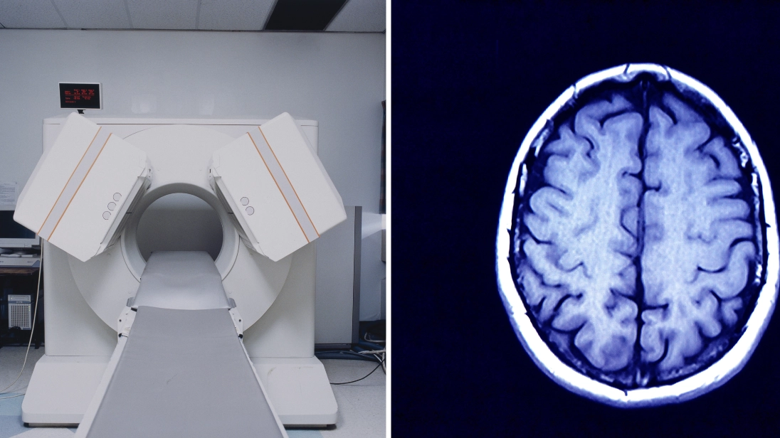 One thing you need to do after neurologist reveals scariest thing she sees people doing to their brains
