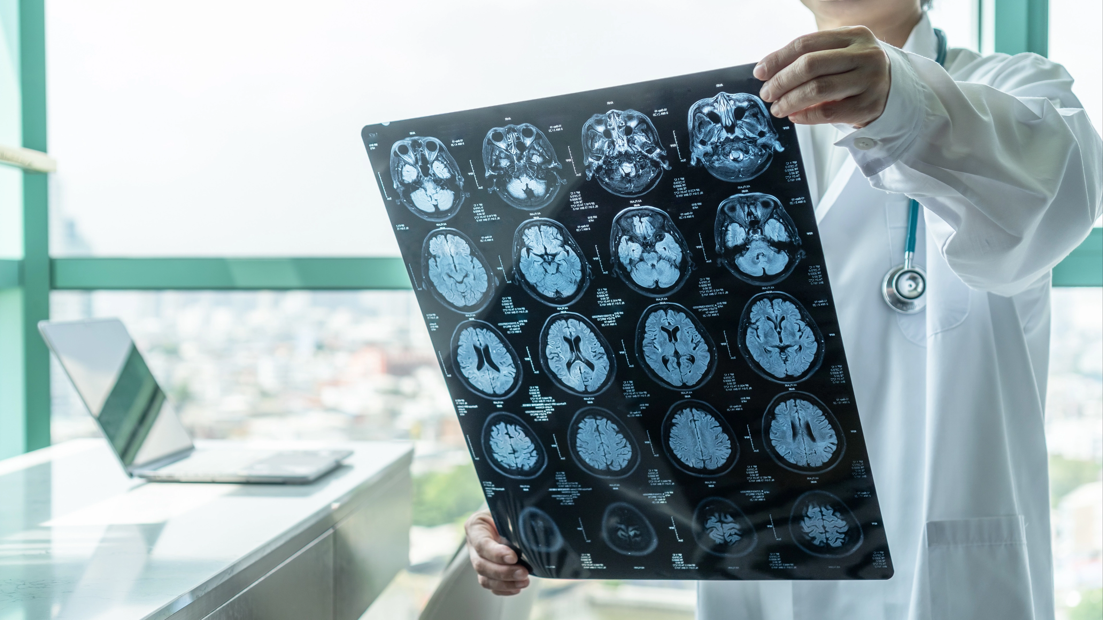 Doctor who's treated 20-year-olds with dementia shares early warning signs you should never ignore
