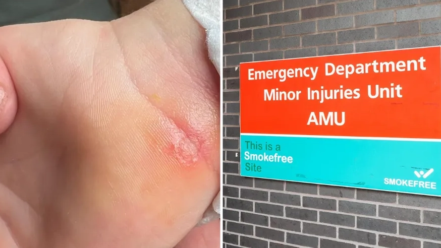 Mum's Warning After Spotting Red Line Growing Up Her Daughter's Arm