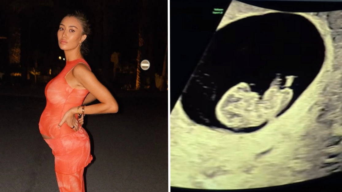 Influencer reveals disturbing side-effect of pregnancy that no one talks about