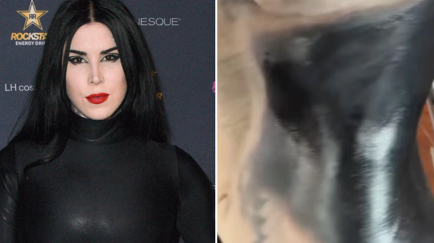 Kat Von D shares results after 'blacking out' 80% of her body with tattoo ink
