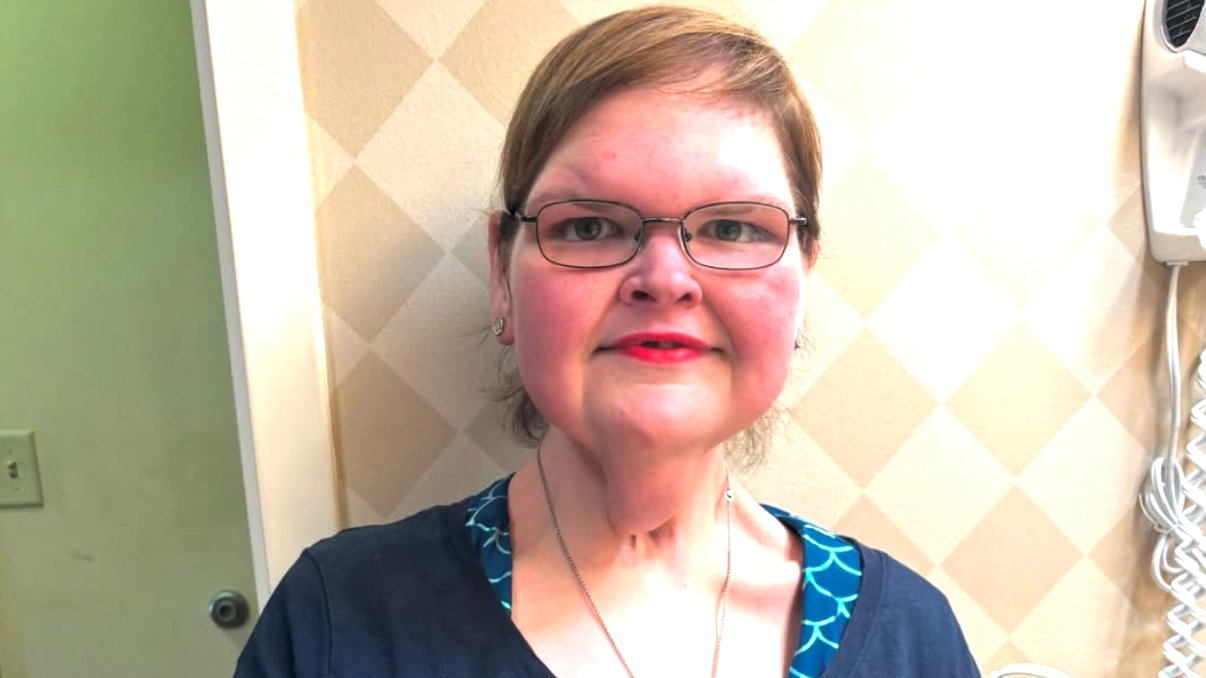 1000-lb Sisters’ Tammy Slaton responds after fans raise concern over facial bruising