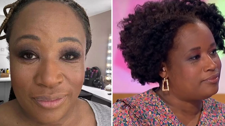 Loose Women star opens up on health diagnosis that left her 'unable to open her eyes'