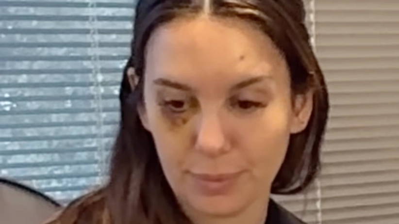Disney star Christy Carlson Romano gives update after being shot in the face on date with husband