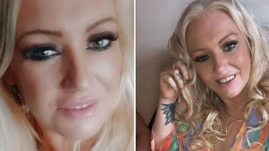 Mum left needing skin graft after she was mauled by friend's sausage dog in horrific attack
