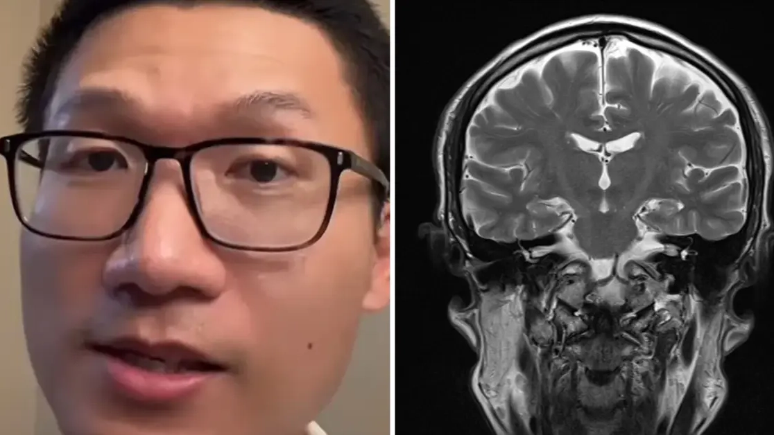 Neurologist reveals the 'most terrifying' condition he’s ever seen