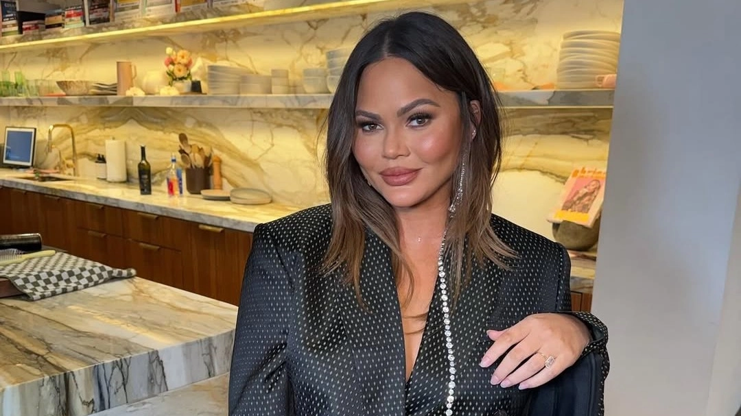 Chrissy Teigen’s ‘whittled tooth’ exposed after Christmas incident