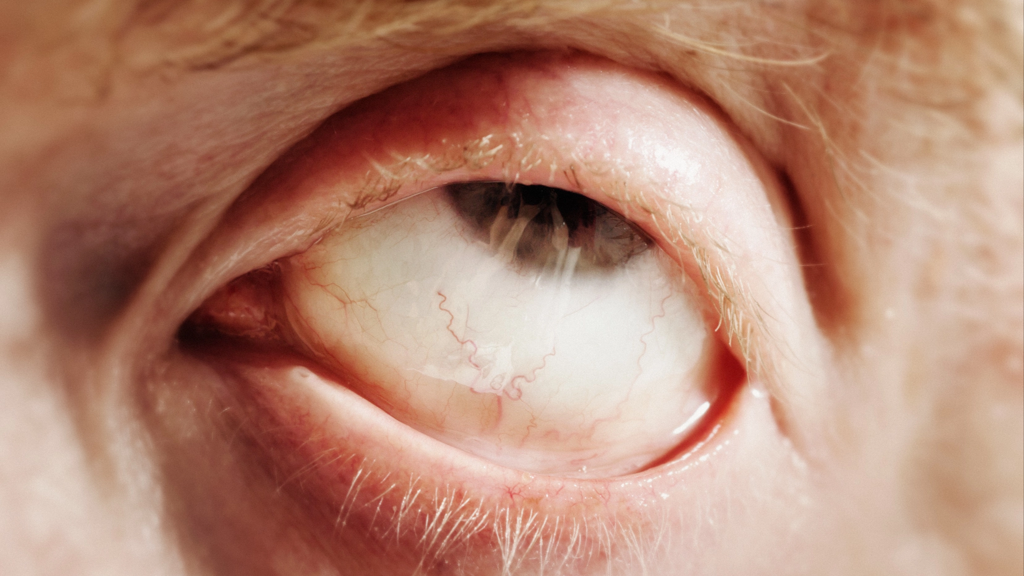 What the 'little holes' next to your eyes are as people stunned after realising