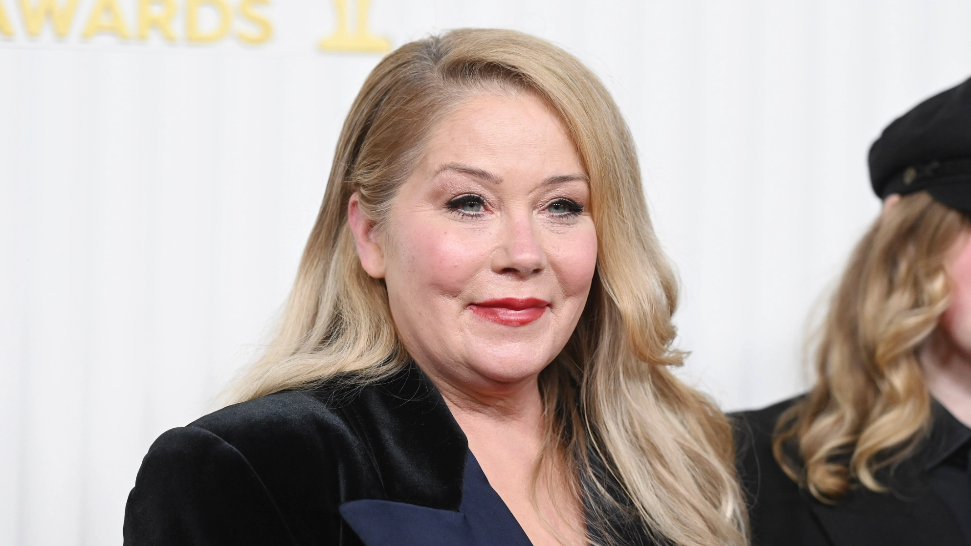 Christina Applegate says one MS side effect has affected her 'more than the disease'