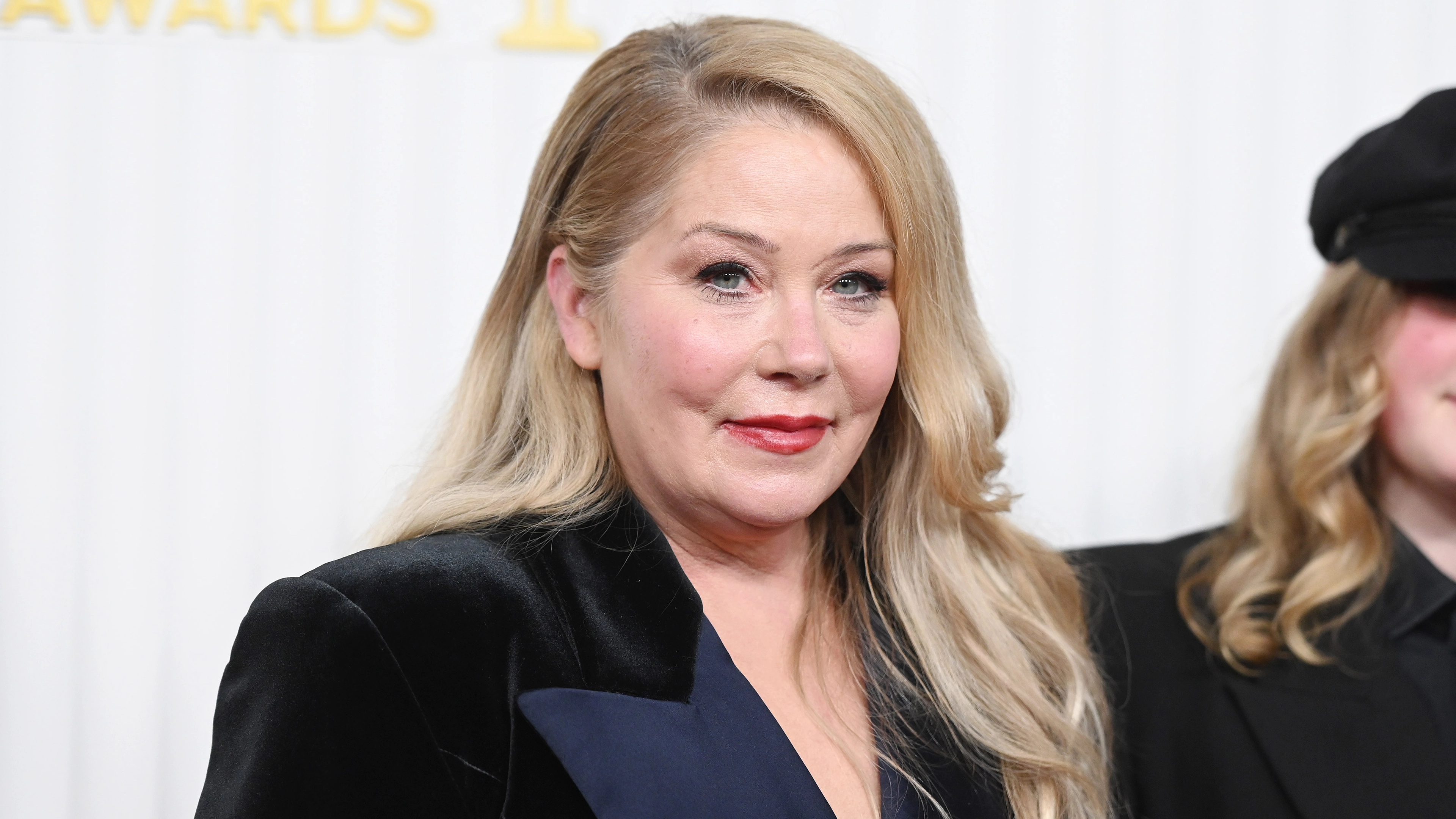 Christina Applegate revealed the symptoms she experienced before realising she had MS