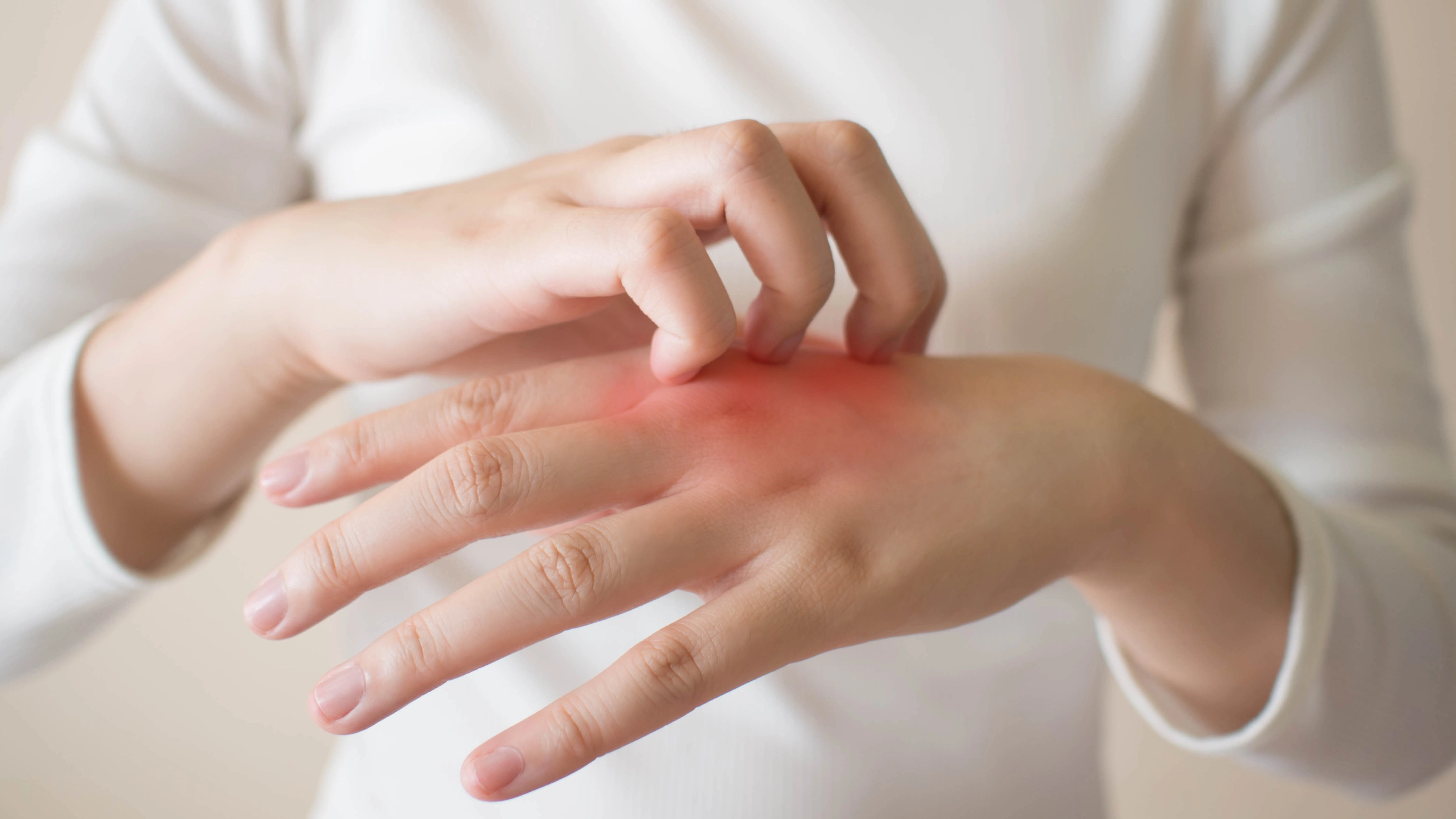 Rash Could Be A Little-Known Omicron Symptom, Expert Warns
