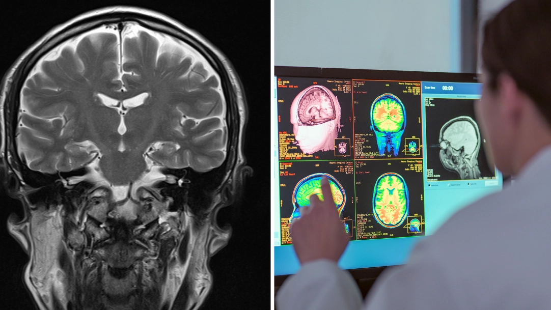 Neurologist reveals the single scariest thing she sees people doing to their brains