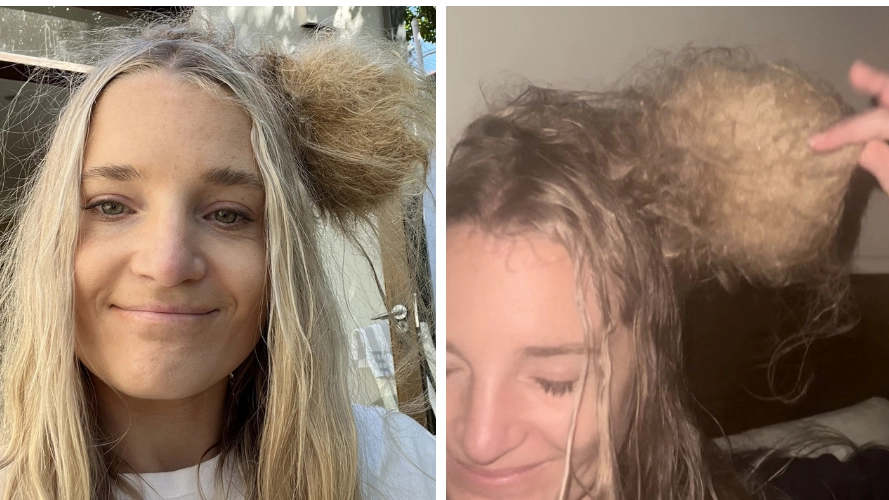Woman had to spend $1,000 removing massive knot from her hair