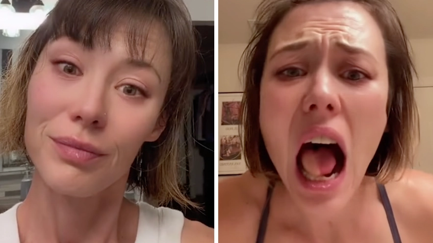 Woman Grows Hairy Tongue After Skin Transplant
