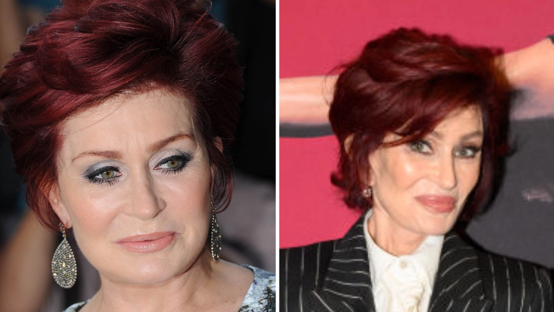 Sharon Osbourne shares worrying Ozempic side effects she experienced after admitting to using drug for weight loss
