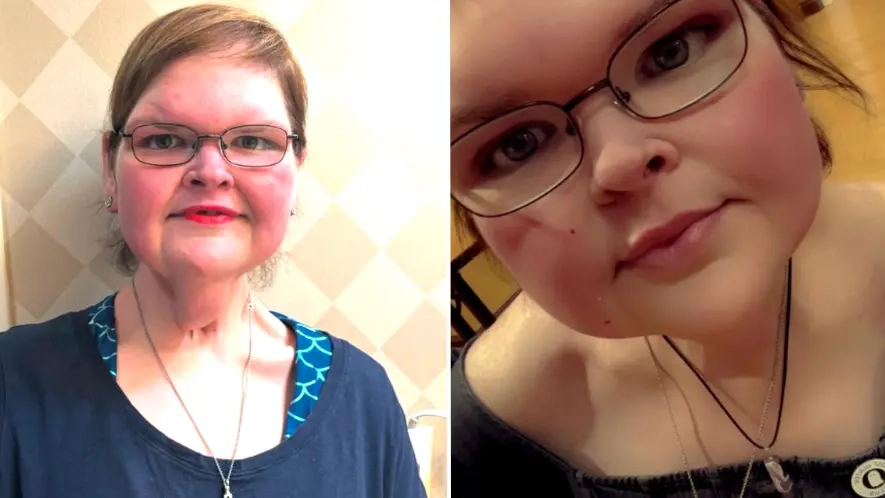 Why 1000-lb Sisters star Tammy Slaton is being refused skin removal surgery following staggering weight loss