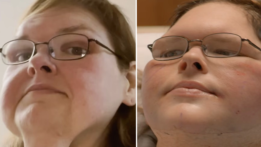 1000-lb Sisters’ Tammy Slaton reveals major skin removal transformation and fans are all having the same reaction