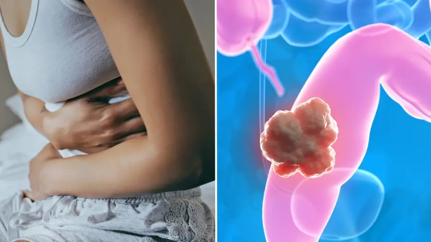 Doctors reveal one way to reduce risk of 'silent killer' after revealing reason behind surge in Gen Z and Millennials