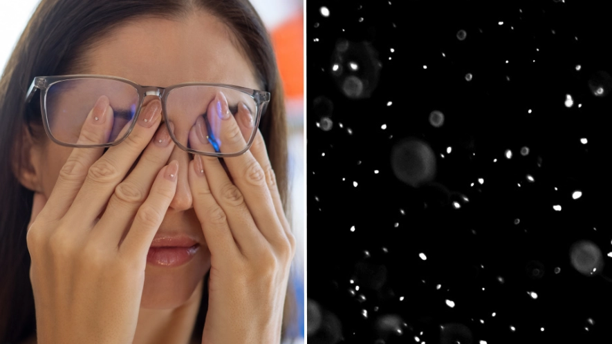 Reason why you’re seeing stars when you rub your eyes