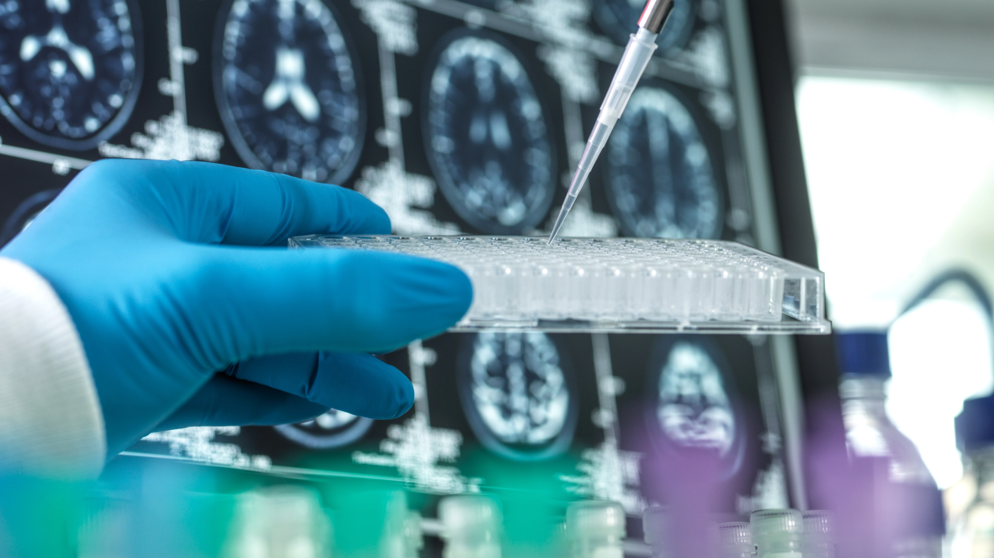 Incurable health condition becomes Britain’s most feared disease over cancer