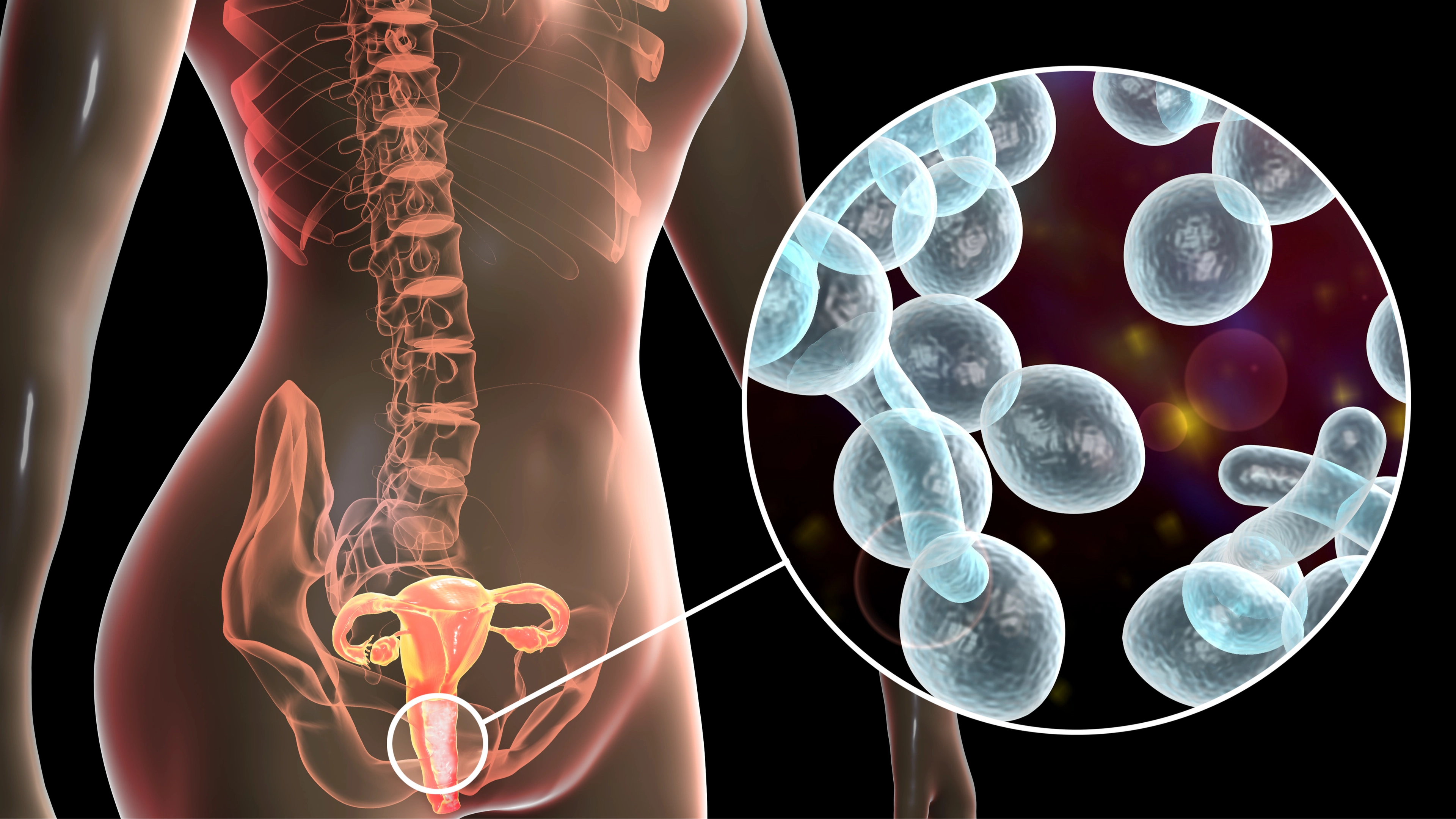 Scientists reveal common infection among women can actually be passed on from men during sex