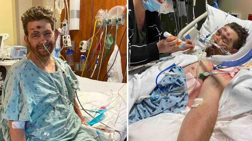 Family of man who had 4% chance of survival after pulling out ingrown hair hit back at trolls wishing he had died