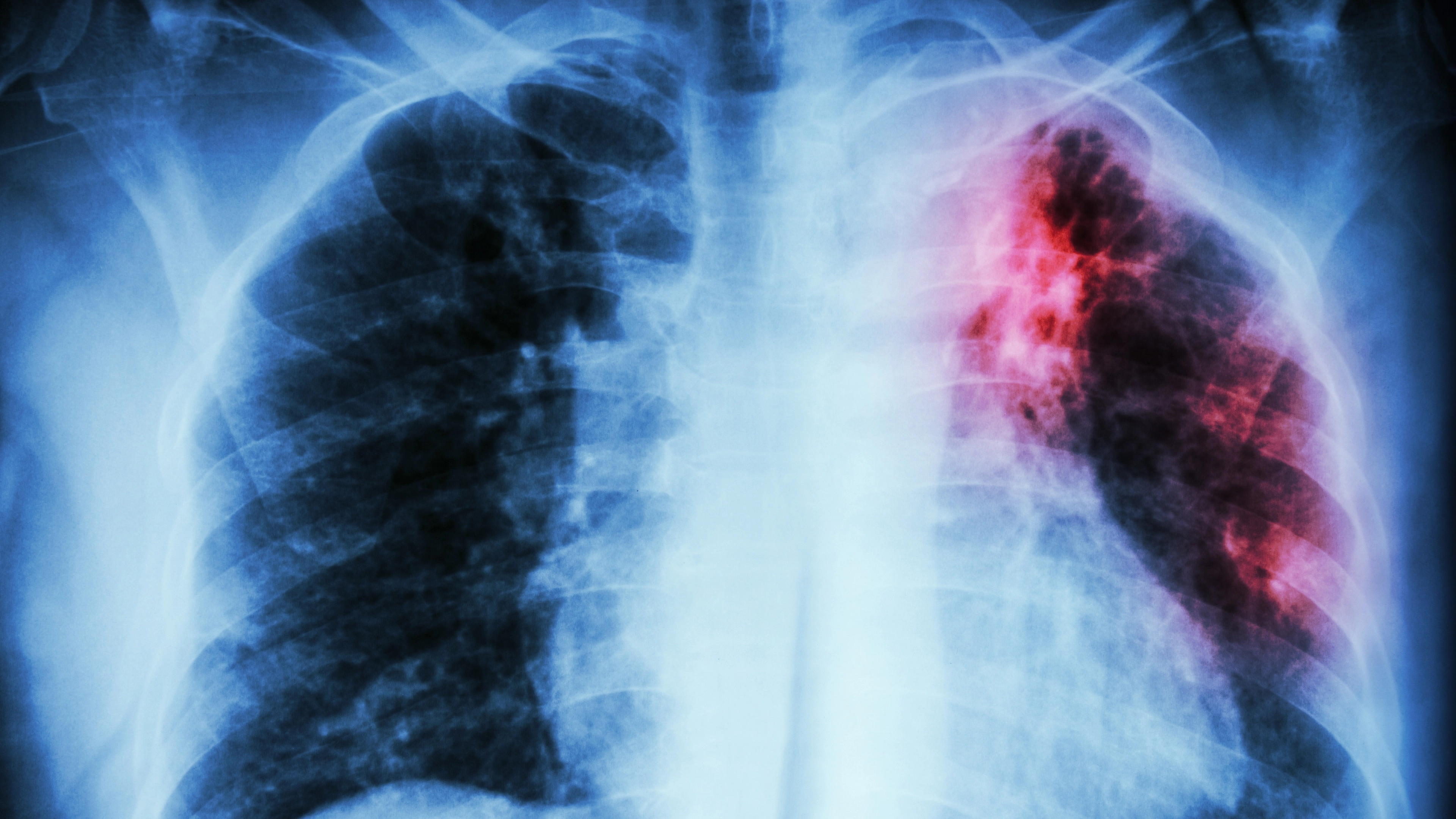 Rare 'Victorian disease' symptoms to watch out for following Amazon warehouse outbreak