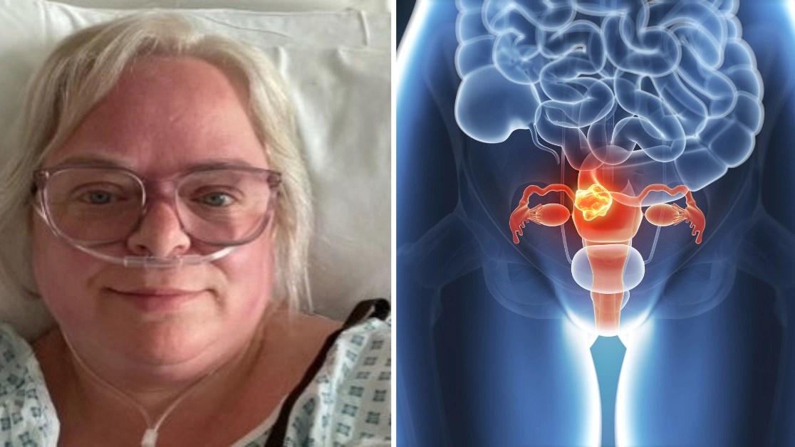 Signs of vulval cancer to look out for as woman gets diagnosis after thinking she just had thrush