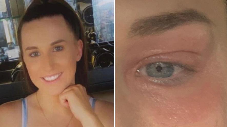 Woman in agony after realising she was allergic to her own period