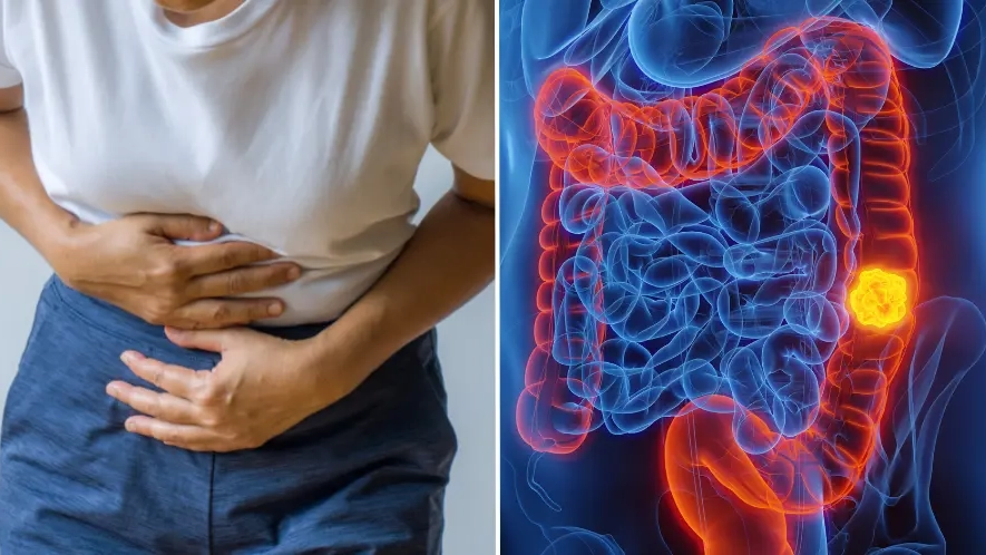 Gen Z and Millennials urged to avoid one particular food after doctors blame it for surge in 'silent killer'