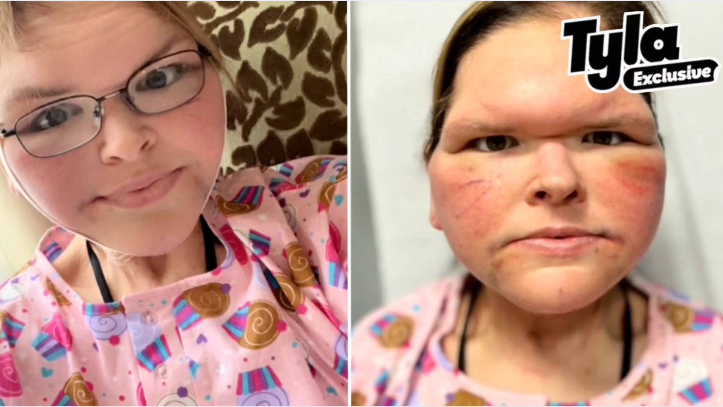 Tammy Slaton's surgeon reveals 'hardest moment' of skin removal surgery process as she shows off dramatic transformation