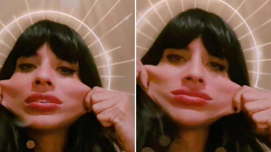 Jameela Jamil explains battle with condition which leaves her with 'elastic skin'