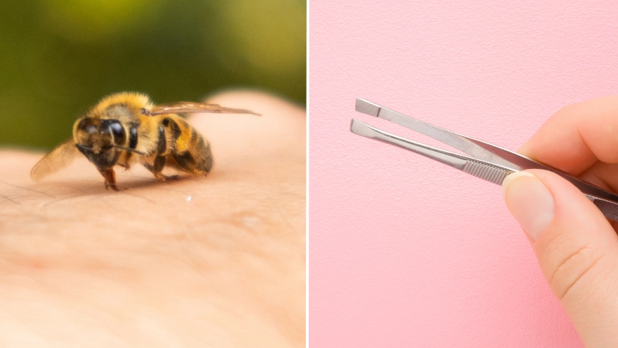 NHS advice on why you should never remove bee or wasp stings with tweezers