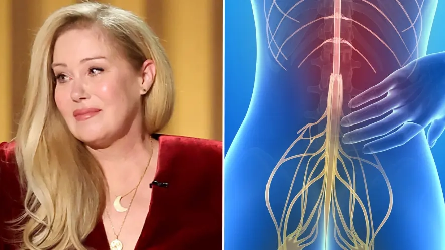 Hidden MS symptoms to look out for as Christina Applegate reveals first sign of condition she noticed whilst filming Netflix pilot
