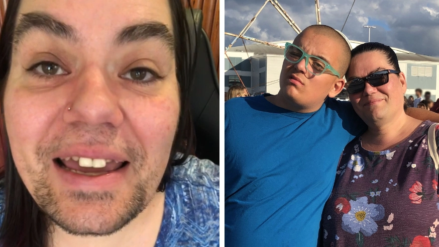 Woman says she's 'more confident than ever' after embracing her facial hair