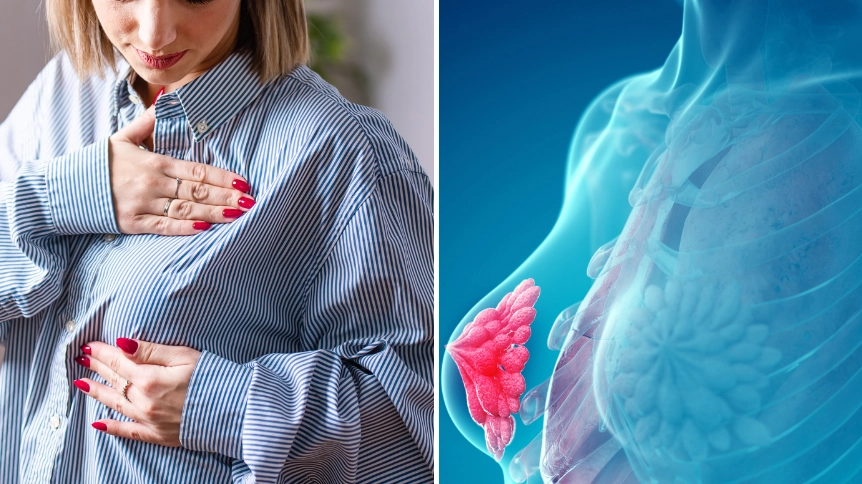 Why you need to seek help if your breast turns specific colour