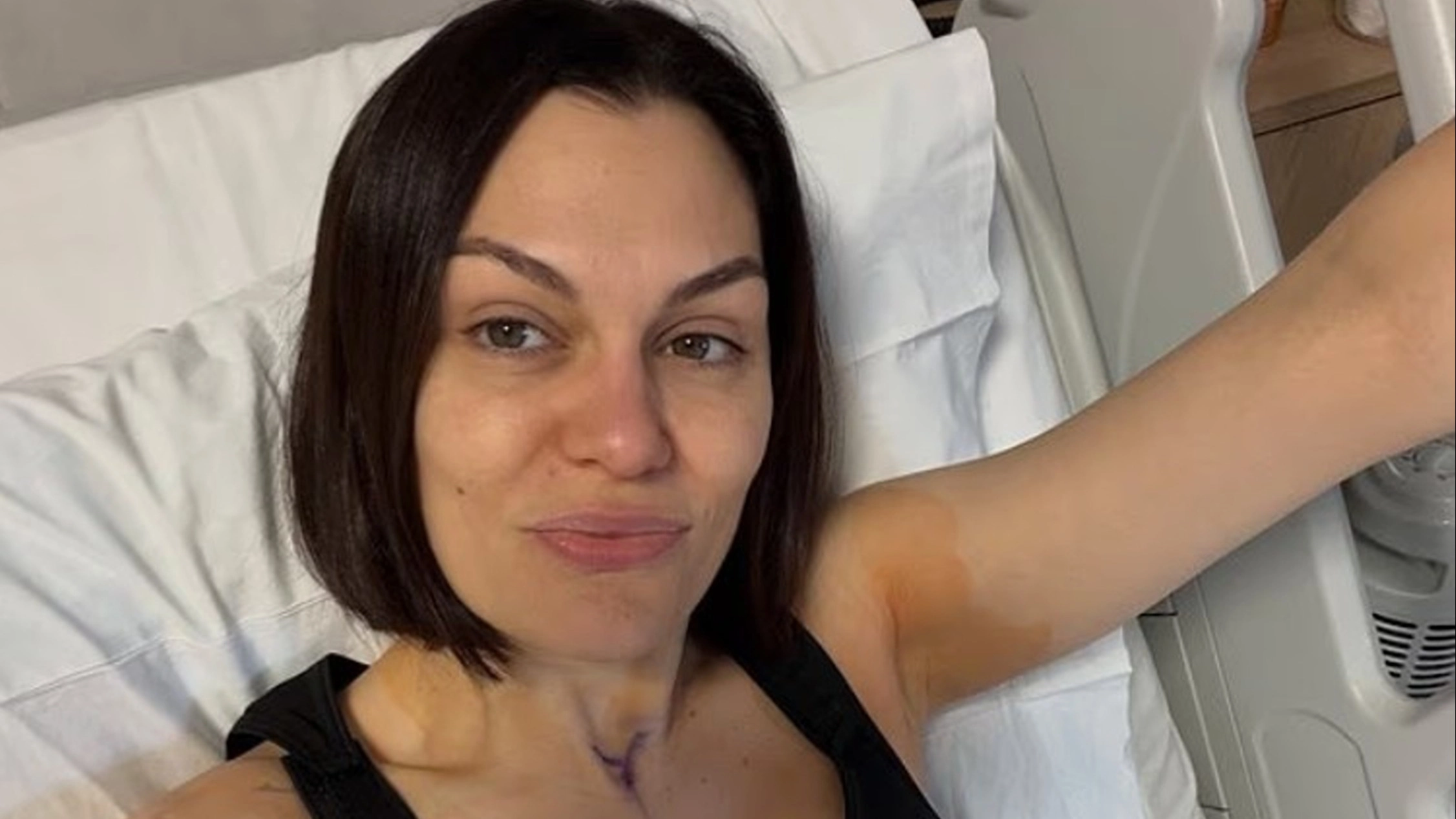 Jessie J, 38, returns to Instagram after second reconstruction surgery following breast cancer