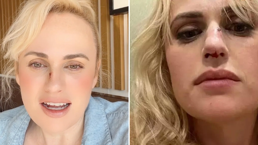 Rebel Wilson shares update after she was taken to hospital when film stunt went wrong