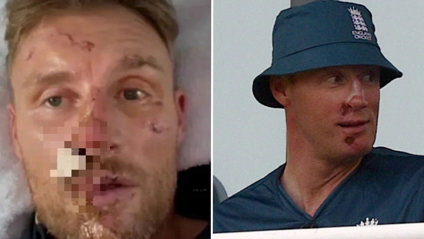 Freddie Flintoff bravely speaks out on disturbing new details of crash that nearly killed him