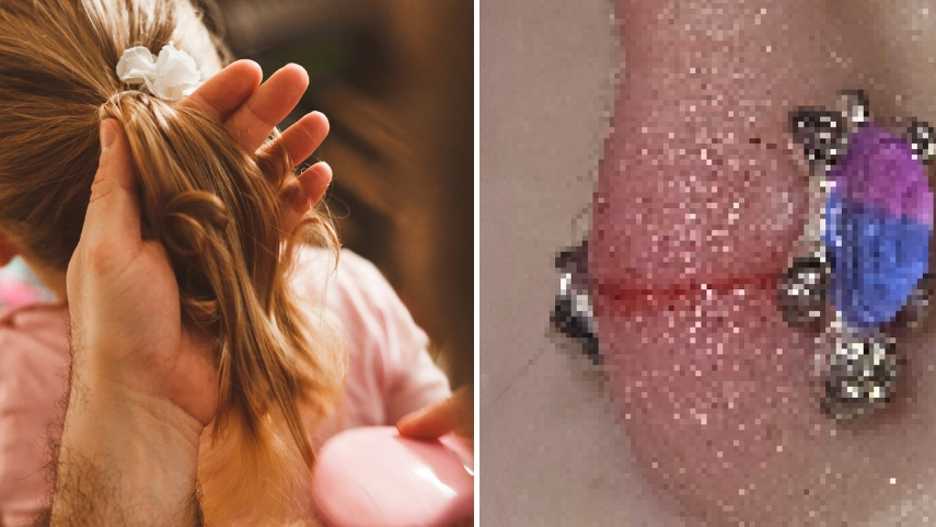 Mum issues urgent warning after hair 'sliced' through her toddler's ear