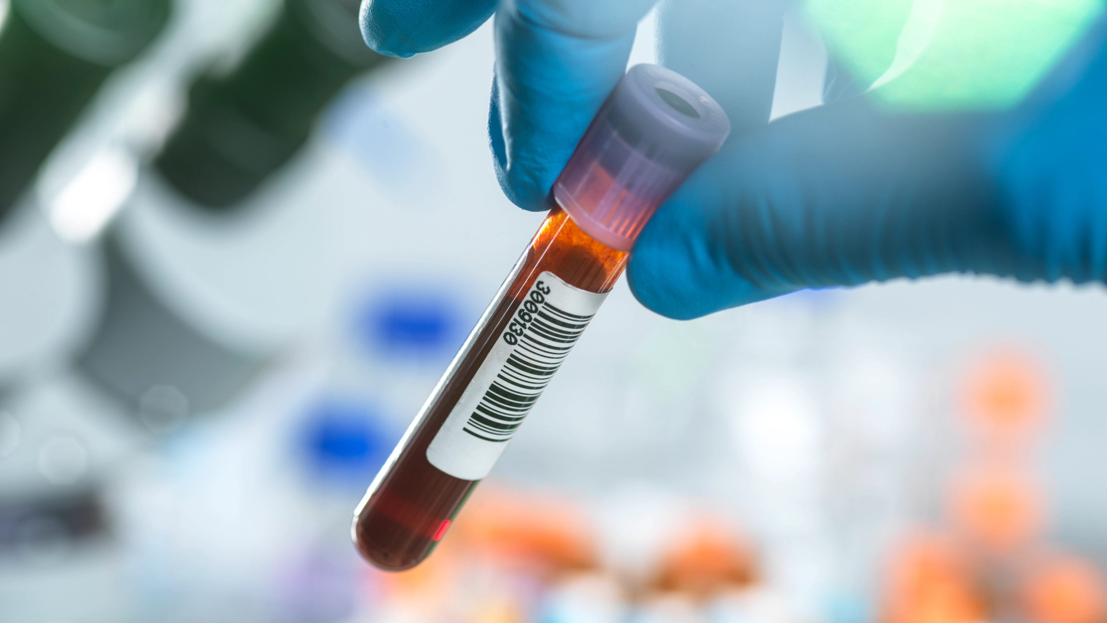 Scientists reveal the one blood type which has the lowest risk of heart disease